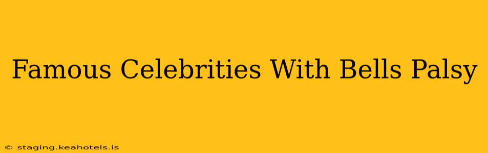 Famous Celebrities With Bells Palsy